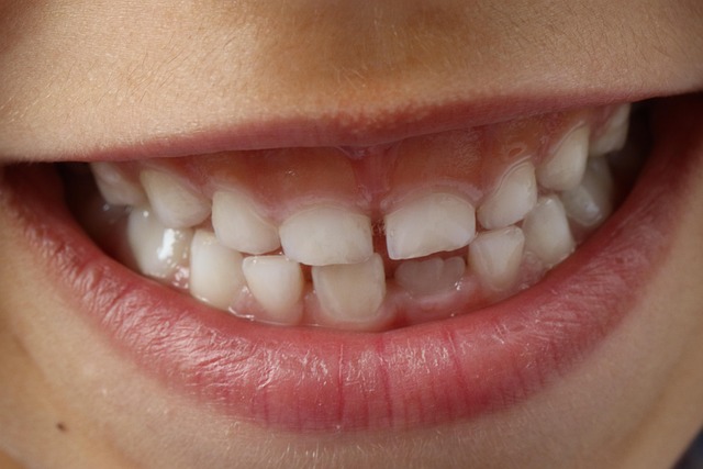Oral Semaglutide Dosing and Tablet Forms Compared